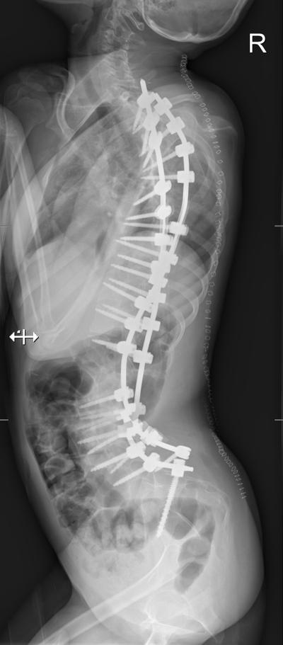 Slide 7