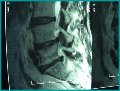 Slide 23