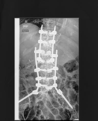 Slide 13